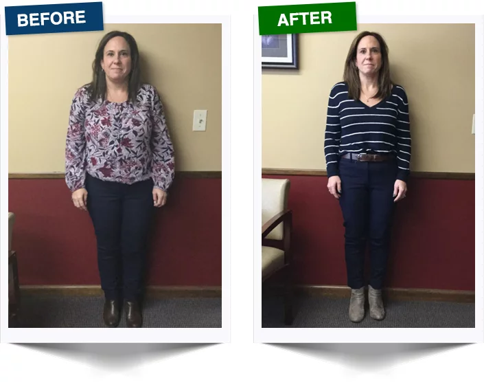 Weight Loss Transformations Get Slim Rochester